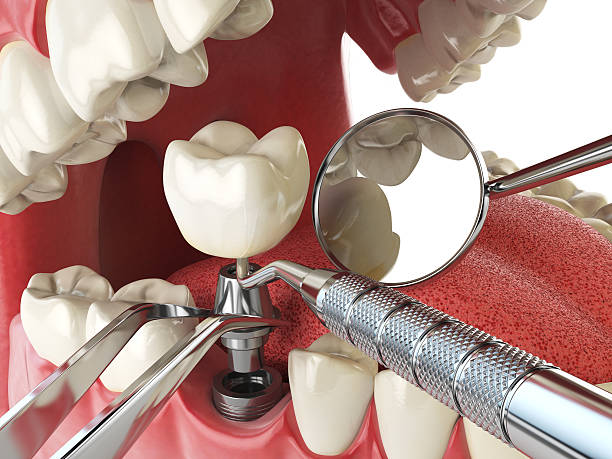 Best Emergency Root Canal Therapy in Baldwin, FL